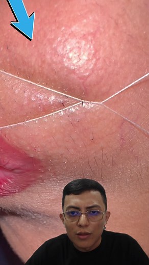 1.8M views · 3.1K reactions | Con un hilo se quita los pelos de la cara #viralreelsfacebook #viralvideochallenge #paratiiiiiiiiiiiiiiiiiiiiiiiiiiiiiii | Pipe G | Facebook