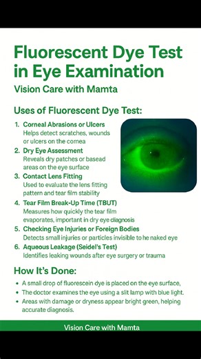 30K views · 291 reactions |  Fluorescein Dye Eye Test A quick,...