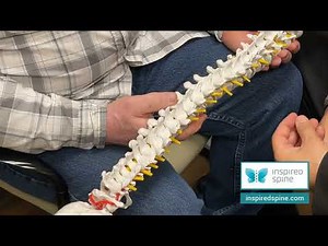 Posterior cervical decompression and fusion explained