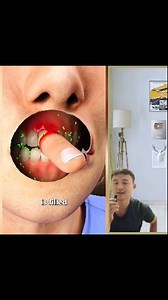 The best way how you should bring your cut finger to hospital as soon as possible. #happening #accident #viralreelschallenge #truestory #knowledgesharing #storytelling #fingers #knowledgeispower | CharLay Voices