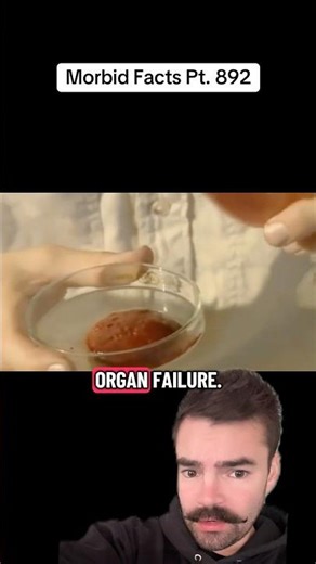 The HORRIFIC effects of snake’s venom on human blood… #morbidfacts