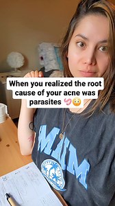 114K views · 801 reactions | The REAL cause of my acne 缾 Since the...