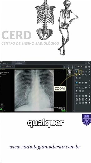 Digital Radiology: Post-Processing Tools