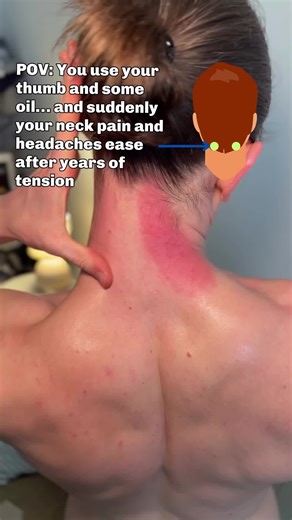 Effective Acupressure Routine for Neck Pain Relief