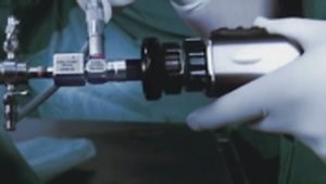 Anatomical Shoulder Update 2: Review of Anatomy & Athletes