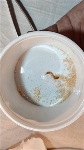 Baby Mealworm to Adult in 45 Days 😱 | Day 1 vs Day 45 Time-Lapse Transformation #shorts #mealworm 🔥.