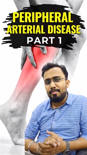 Peripheral artery disease- Part 1