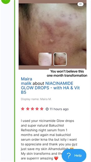 6.9K views | Skin Deep on Reels | Facebook