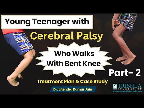Young Teenager with Cerebral Palsy and Bent Knee Successfully Walks | Part 2 | Trishla Foundation