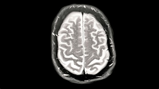 Scientists uncover 'death switch' hidden in the brain that could fuel Alzheimers