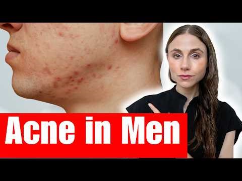 Adult Male Acne Explained: Testosterone, Medications & Hidden Causes