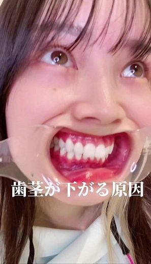 歯茎マッサージのやり方と効果