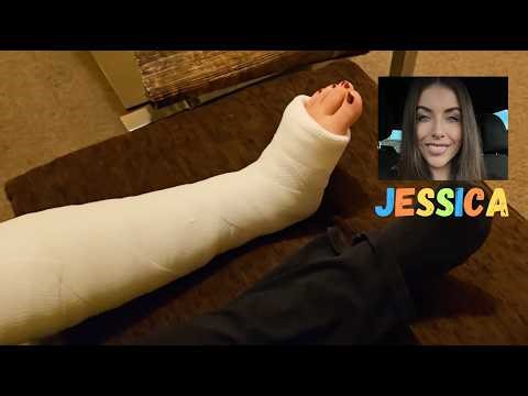 Short Leg Cast