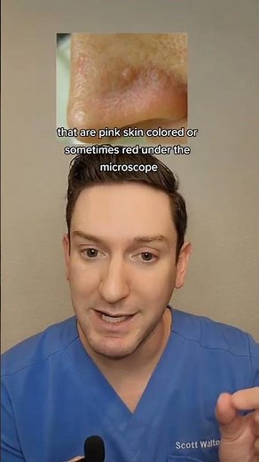 Bump on your nose? Dermatologist explains: What is that on your face [Episode 1]