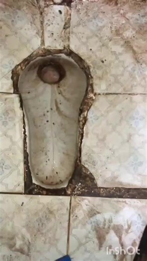 #trendingvideo #foryoupage # stain remover works best on stained toilet