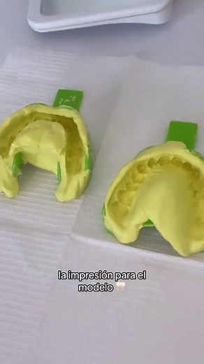Modelo de Estudio Dental: Técnicas y Proceso