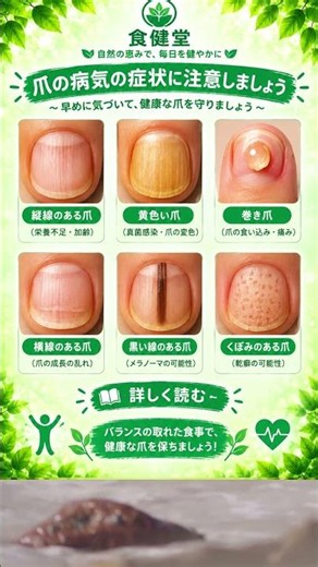 見逃してはいけない爪の異常サイン｜健康状態がわかる重要な症状とは？