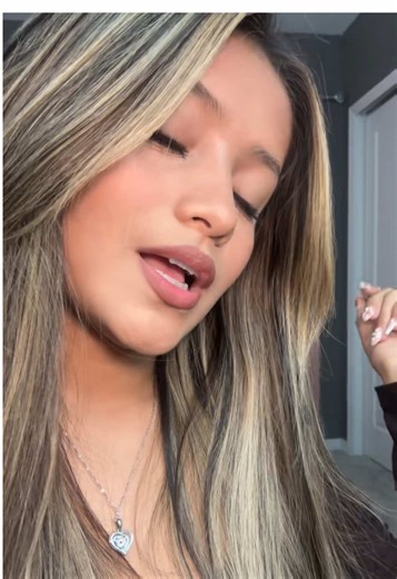 Lip Flip Transformation with Braces