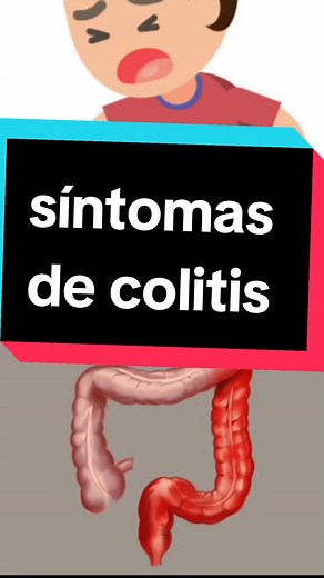 Síntomas de Colitis: Descubre sus Signos y Tratamientos Efectivos