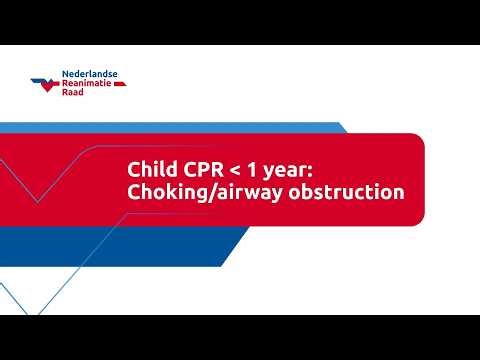 Child CPR younger than 1 year: Choking/airway obstruction