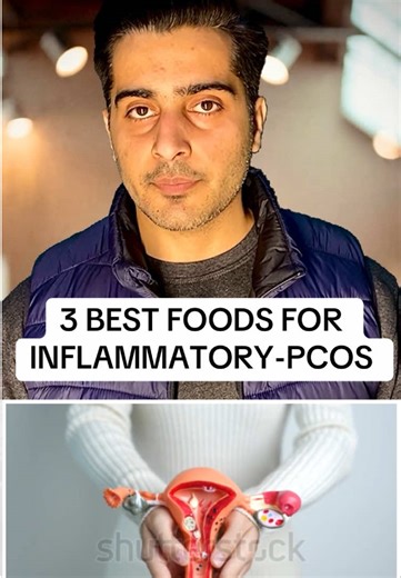 Understanding Polycystic Ovarian Syndrome (PCOS)