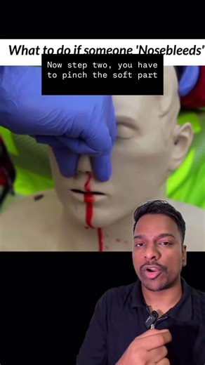 Nose Bleeding Treatment #medicine #medicalemergency