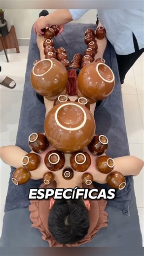 ¿Por Qué Este Hombre Tiene Ventosas en Toda la Espalda? 😳
