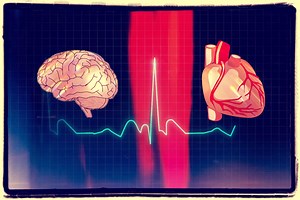 Psicofarmaci e allungamento del QT e QTc - Valerio Rosso