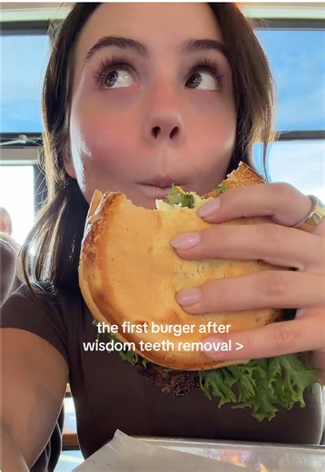 The First Burger After Wisdom Teeth Removal