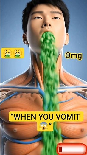 What Happens Inside Your Body When You Vomit? 🤮(3D Medical Animation) #humanbodyx #usa #shorts #yt