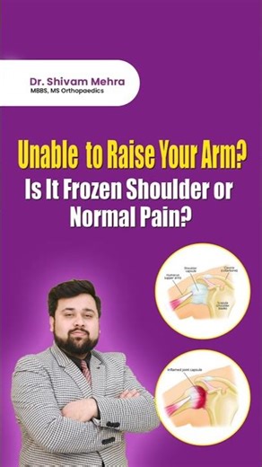 Shoulder Pain? Warning Signs You Should Never Ignore | Early Orthopedic Advice #shoulderpain