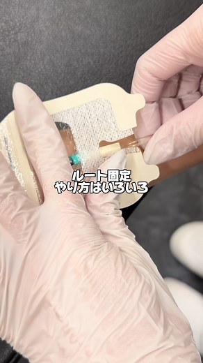 Ω作るとかなり固定されます！ #ルート固定 #点滴 #看護師