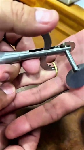 Safe and Effective Medical Ring Cutter for Emergency Removal #thermalcutting