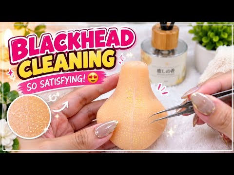 😱 BLACKHEAD CLEANING! So Satisfying to Watch! ✨