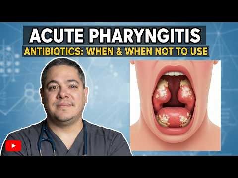 Viral vs. Bacterial Pharyngitis: Do You Really Need Antibiotics? What I tell my Patients