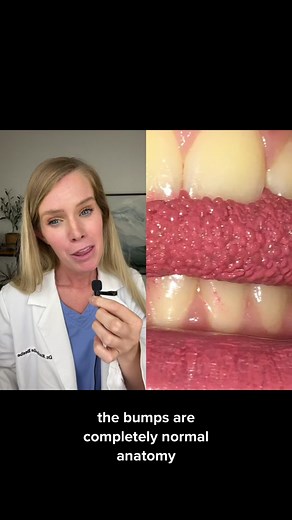 Understanding Tongue Anatomy: A Fun Exploration