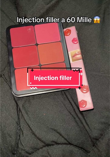 Injection filler a 60 Mille #العناية_بالبشرة #skincaretips #tips #skincarereview #skincare #fypシ゚viral🖤tiktok #skincarereviewph