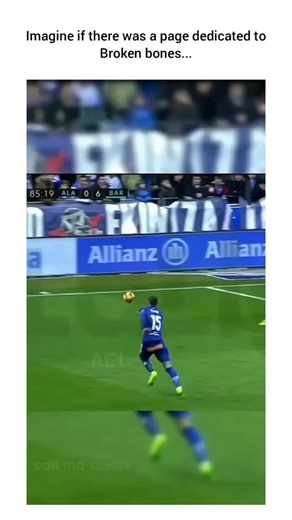 Posting Broken Bones on Instagram: "If only there was a page dediacted to broken bones... Looking to grow? Follow @brown_derrek and get featured - no strings attached. Music by: @thechainsmokers - Smooth #StayStrong #HealingJourney #BrokenBones #PainToPower #NeverGiveUp #Injc uredButNotDefeated #RecoveryMode #KeepPushing #Resilience"