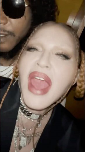 Madonna's Grammys Transformation: Facelift or Downfall?