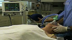 Fiberoptic Intubation(支气管镜插管)
