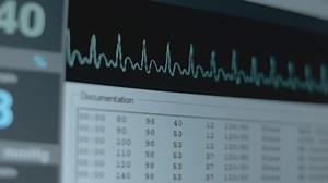 Download Close-up view of the screen of patient monitor displays vital signs ECG electrocardiogram EKG and oxygen saturation SPO2