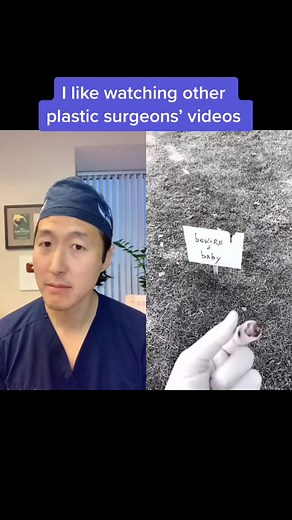 57K views · 335 reactions | Watch very, very closely... #horror #plasticsurgeon #plasticsurgery #scare #halloween | Dr. Anthony Youn | Facebook