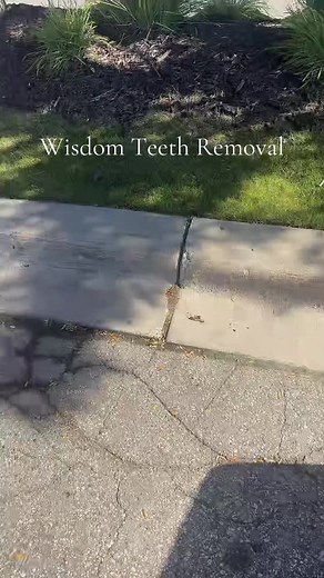 Just got these mf wisdom teeth removed mouth hurt like a hoe 😭🦷 #wisdomteeth #dentist