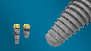 NobelReplace® Conical Connection | Nobel Biocare Canada (EN)