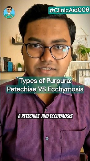 Types of Purpura: Petechiae VS Ecchymosis for USMLE, NEET PG, NCLEX, INICET