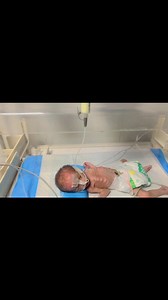 2.7K views · 48 reactions | Newborn Premature Baby’s First NG Tube Feeding Explained | NICU Care‍ #NICUCare#NGTubeFeeding #viral #newborn #trending #cutebaby #baby | Anoop Gautam | Facebook