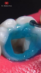 10K views · 160 reactions | Wonderful Reconstruction!! #Shorts #dentalclinic | Dental Videos | Facebook