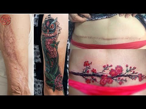 Wonderful Tattoos That Turn Scars Into Works Of Art #2