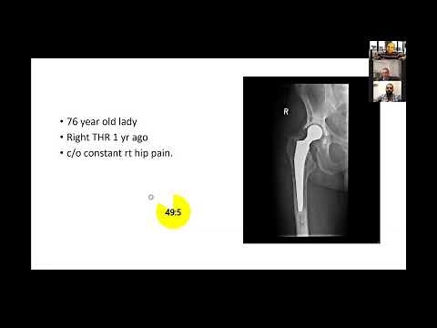 Periprosthetic joint infection - viva practice for the FRCS Trauma and Orthopaedics exam