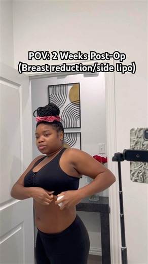POV: 2 Weeks Post-Op (Breast reduction/side lipo)